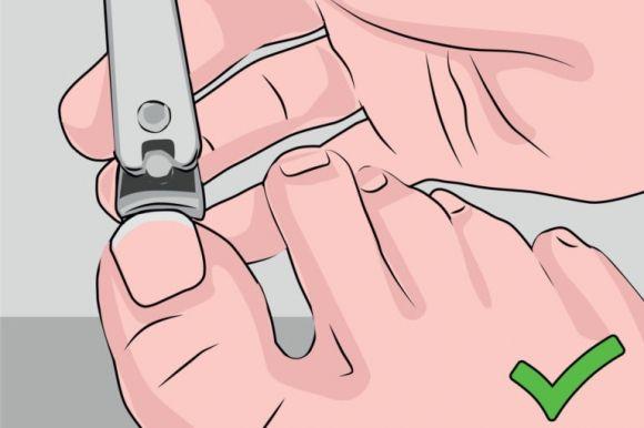 Як доглядати за стопами та нігтями при діабеті? 15 головних правил - 9 фото Як доглядати за стопами та нігтями при діабеті? 15 головних правил - 9 изображение