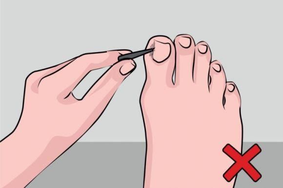 Як доглядати за стопами та нігтями при діабеті? 15 головних правил - 10 фото Як доглядати за стопами та нігтями при діабеті? 15 головних правил - 10 изображение