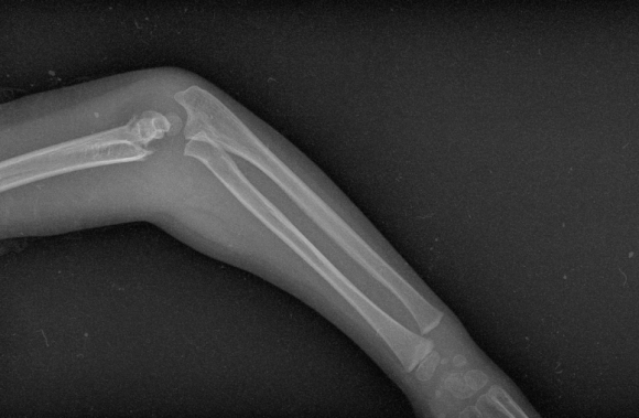 Не ігноруйте ці сигнали організму! 12 дивних симптомів, з якими варто звернутися до ендокринолога - 2 фото Не ігноруйте ці сигнали організму! 12 дивних симптомів, з якими варто звернутися до ендокринолога - 2 изображение