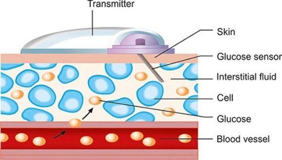 Що таке CGM? Все, що вам потрібно знати про безперервний моніторинг глюкози - 2 фото Що таке CGM? Все, що вам потрібно знати про безперервний моніторинг глюкози - 2 изображение