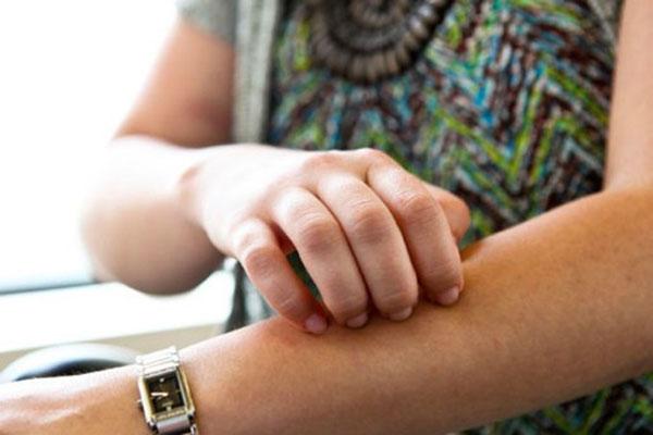 Проблемы с кожей при сахарном диабете - 4 изображение