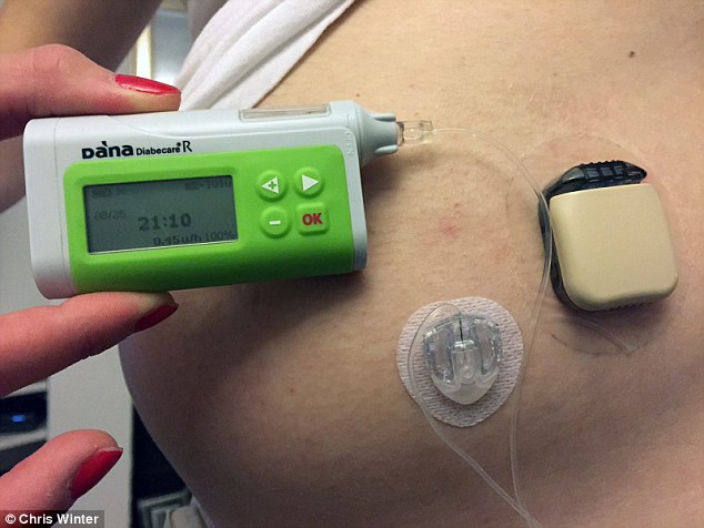 Прощайте 10 инъекций инсулина в день - как проходит моя диа-беременность - 4 изображение