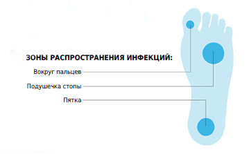 ПЕКТИНАР: Новый, ​эффективный и безопасный препарат для лечения диабетической стопы - 3 изображение