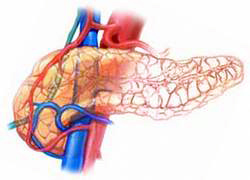 Искусственная поджелудочная: отзыв пациента - обзор плюсов и минусов - 3 изображение