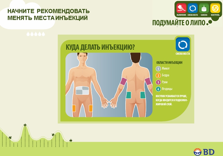 Липогипертрофия при диабете: инфографика, данные исследований. ПРЕЗЕНТАЦИЯ - 12 изображение