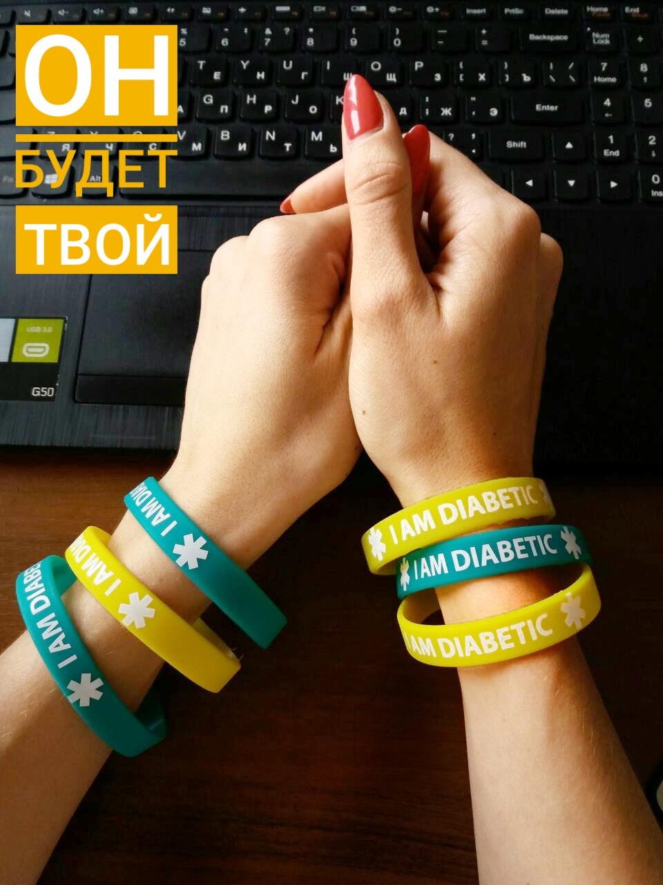 ID-браслетики за голосование на DiaБренд 2017! - 4 изображение