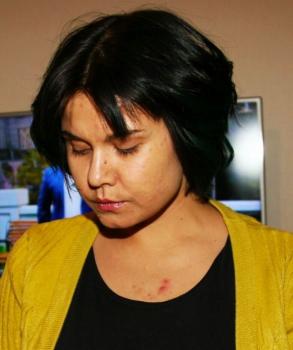 Применение крема Diabetegen при диабете: отчет 4 - 3 изображение