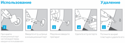 Инъекционный порт для безболезненного введения инсулина. Обзор от ``Сахарка`` - 4 изображение