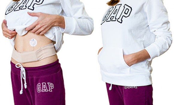 INSULA - универсальный аксессуар для вашей помпы - 2 изображение