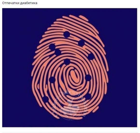 ТОП 10 юмористических картинок о диабете от ``Сахарка`` - 10 изображение