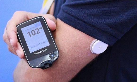 Dexcom G5 оказался лучше FreeStyle Libre в борьбе с гипогликемией: исследование - 2 изображение