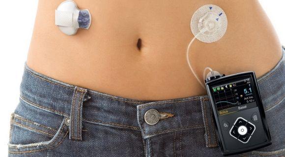 MiniMed 670G можно будет купить в Европе к концу 2018 года - 2 изображение