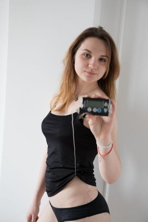ФОТОпроект ``Красивый диабет`` - 5 изображение