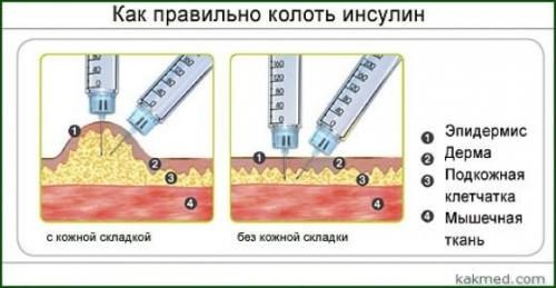 Что такое инсулин: от А до Я - 4 изображение