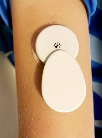 Bubble. Новая система мониторинга для сенсоров Freestyle Libre. ОБЗОР от Сахарка - 3 изображение