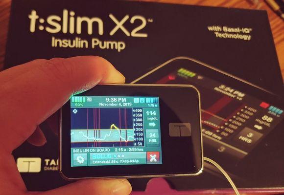 Control-IQ - система закрытого цикла для для подачи инсулина - 2 изображение