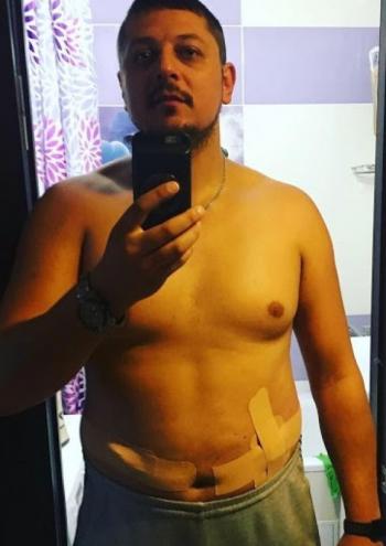 Чем и как приклеить сенсор мониторинга глюкозы. Обзор вариантов, советы, лайфхаки - 11 изображение