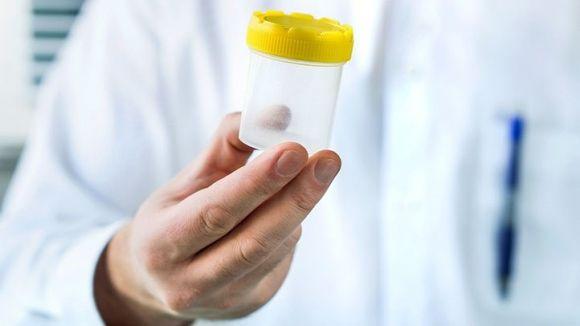 Внимание на почки. Большая пятерка сердечно-сосудистого риска - 3 изображение