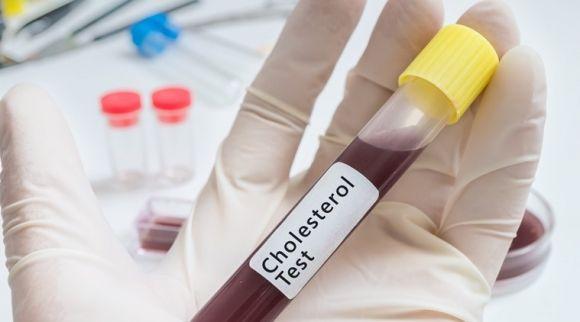 Инсулин, гормоны, углеводы, гены и другие причины повышенного холестерина - 2 изображение