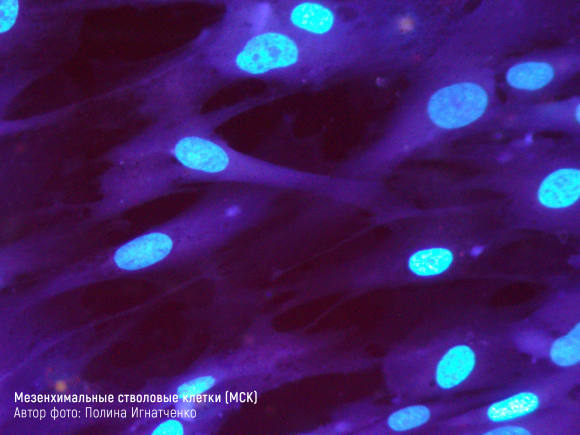 Инновации в лечении диабета. Мезенхимальные стволовые клетки - 5 изображение