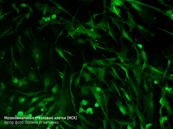 Инновации в лечении диабета. Мезенхимальные стволовые клетки - 4 изображение