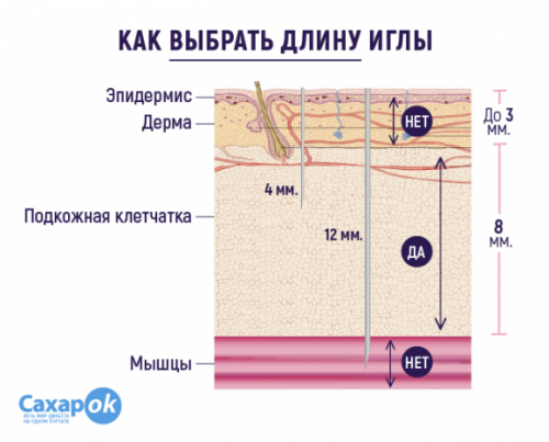 ТОП-5 cоветов для безболезненных инъекций инсулина от SaharOK Journal - 2 изображение