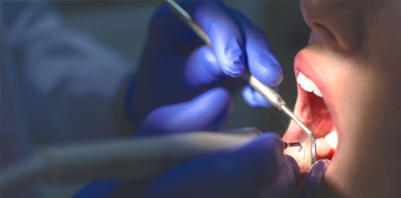 Диабет и зубы: как сохранить красивую улыбку - 2 изображение