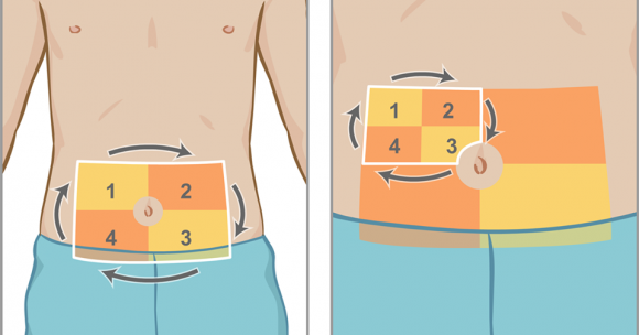 ТОП-5 порад для безболісних ін'єкцій інсуліну - 2 изображение