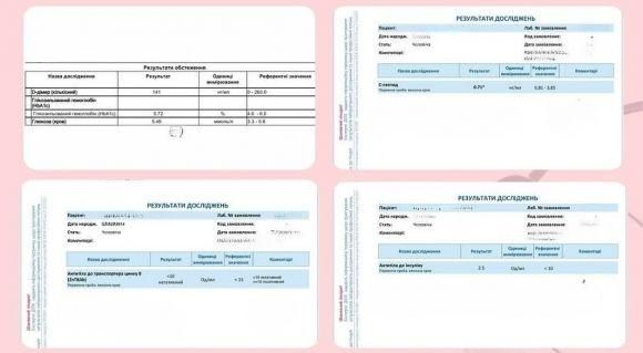 Кейс: рідкісний цукровий діабет, або історія зі «щасливим» кінцем - 4 изображение