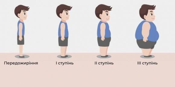 Дитяче ожиріння: симптоми, діагностика та лікування - 2 изображение